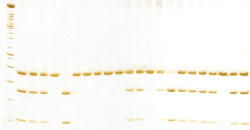2 poliacrilamida cyp17