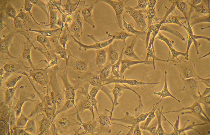 A172 cells