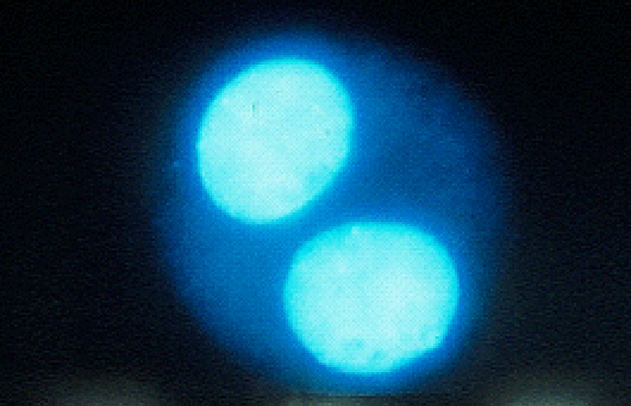 MN1