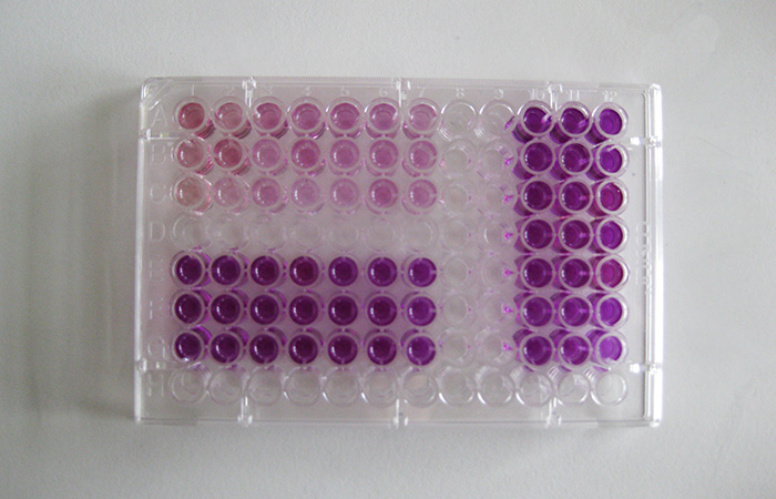 MTT assay