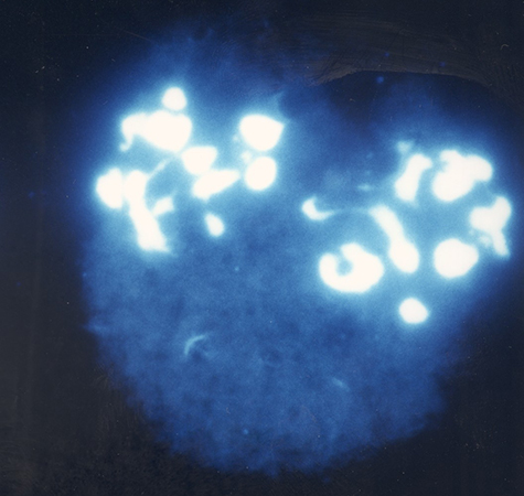 apoptosis